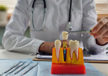dental implants in Simi Valley