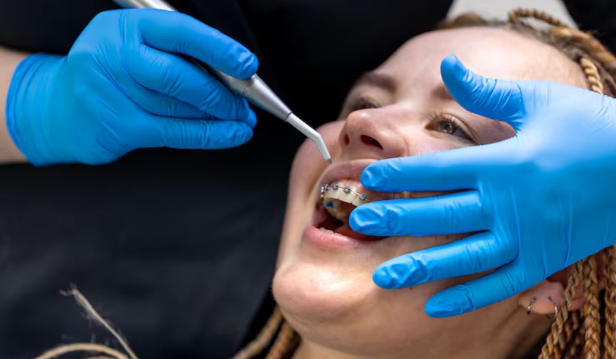 Different Types of Teeth Straightening Treatments Explained