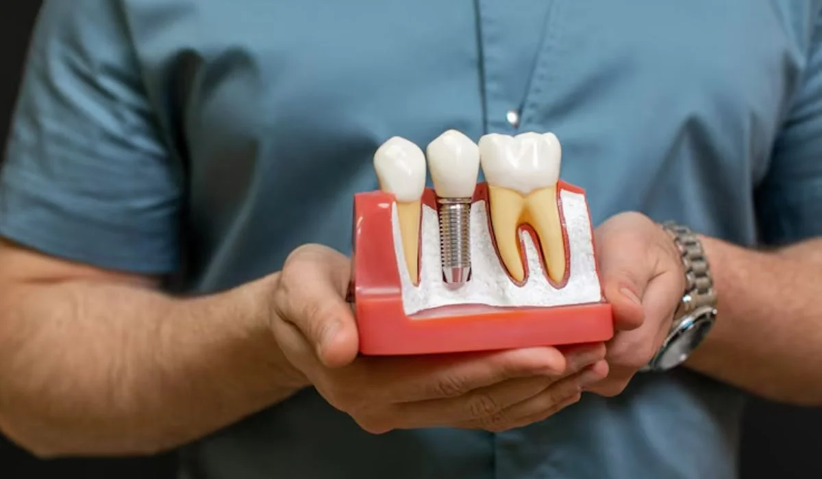 dental implant in Simi Valley