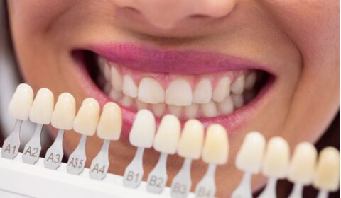 professional dental cleaning